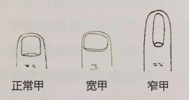  指甲发紫的生理机制与心血管预警：从临床病例到自我检测的系统指南 健康养生